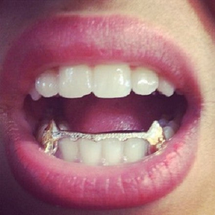 Custom Made 14k Gold Overlay Removable Grillz Teeth /Gold Plate Caps/ 6 Teeth Top or Bottom Fangs/13