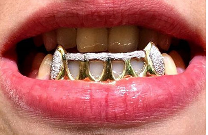 Custom Made 14k Gold Overlay Removable Grillz Teeth /Gold Plate Caps/ 6 Teeth Top or Bottom Fangs/9