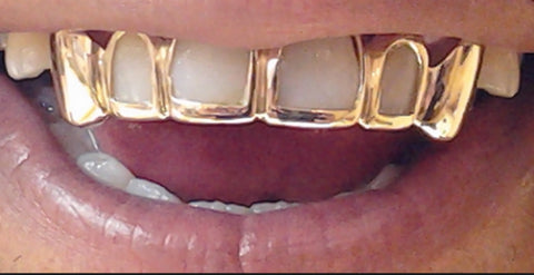 Custom Made 14k Gold Overlay Removable Grillz Teeth /Gold Plate Caps/ 6 Teeth Top or Bottom Fangs/5