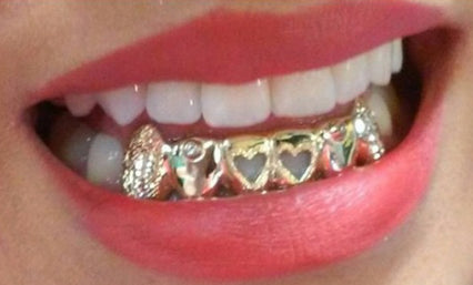 Custom Made 14k Gold Overlay Removable Grillz Teeth /Gold Plate Caps/ 6 Teeth Top or Bottom Fangs/3