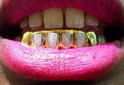 Custom Made 14k Gold Overlay Removable Grillz Teeth /Gold Plate Caps/ 6 Teeth Top or Bottom Fangs/10