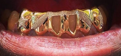 Custom Made 14k Gold Overlay Removable Grillz Teeth /Gold Plate Caps/ 6 Teeth Top or Bottom Fangs/7